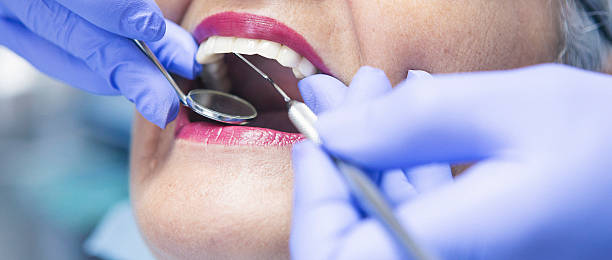 Best Knocked-Out Tooth (Avulsed Tooth) Treatment in Whitley City, KY