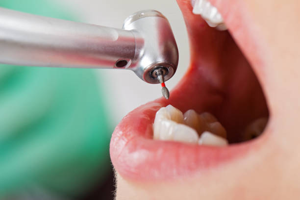Professional Emergency Dental Service in KY
